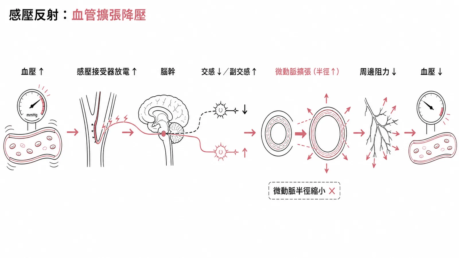 感壓反射降壓流程：血管擴張而非收縮