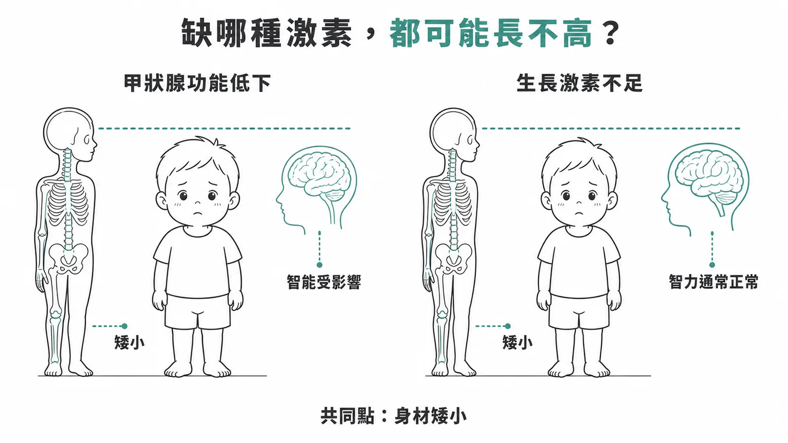甲狀腺功能低下與生長激素不足都會導致新生兒身材矮小，但只有甲狀腺低下會影響智能