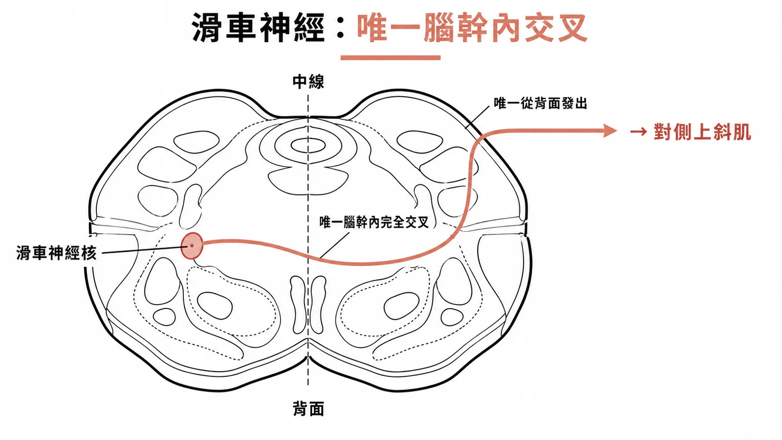 滑車神經腦幹內交叉示意圖:唯一從背面發出且纖維完全交叉的腦神經
