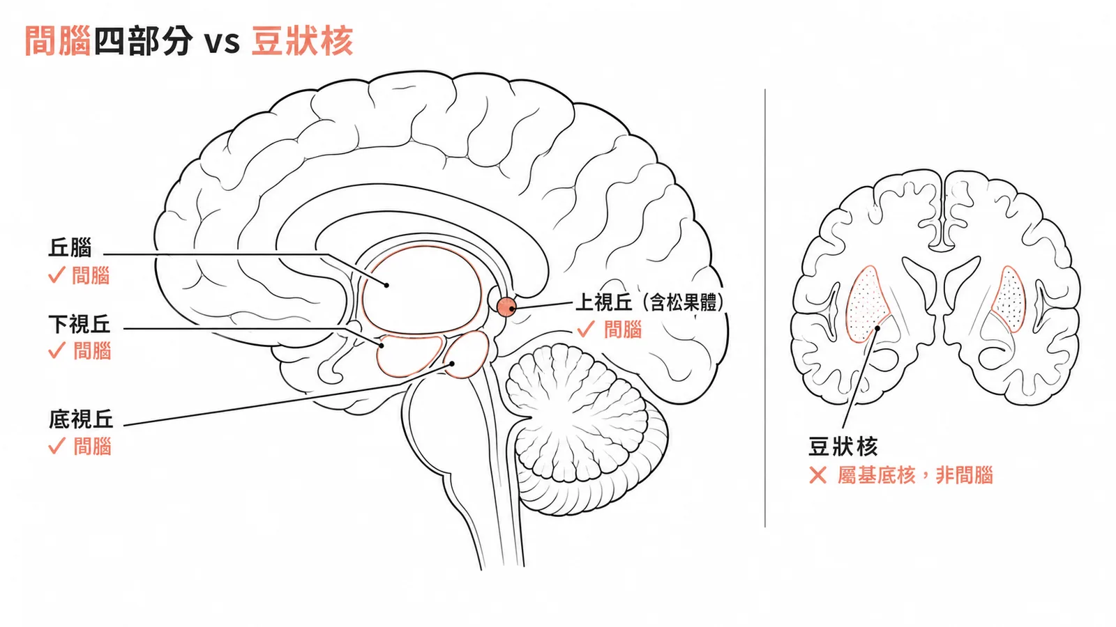 間腦四部分(丘腦、下視丘、上視丘、底視丘)與豆狀核對照