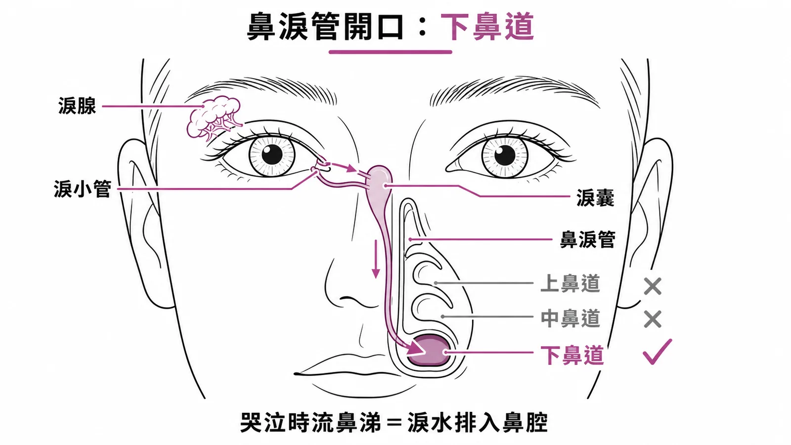 鼻淚管排出路徑：淚腺經淚小管、淚囊、鼻淚管開口於下鼻道
