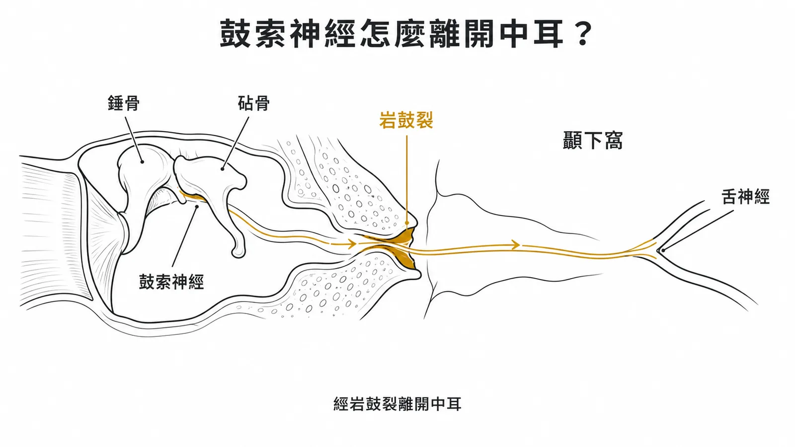 鼓索神經經岩鼓裂離開中耳進入顳下窩的路徑示意圖