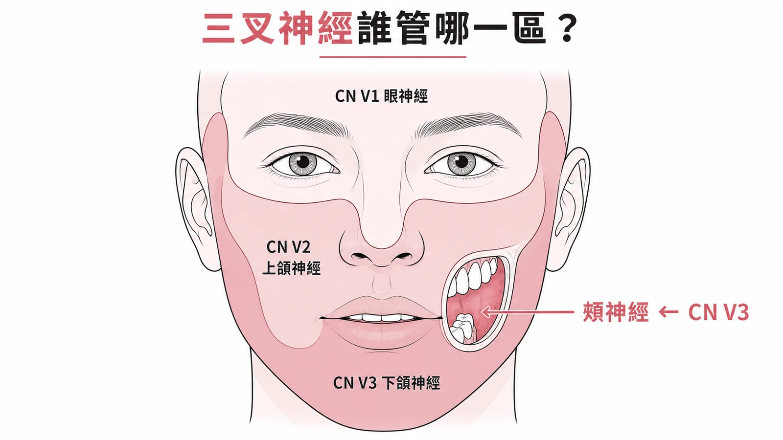 三叉神經三分支感覺分區:CN V3 的頰神經負責口腔內頰黏膜感覺