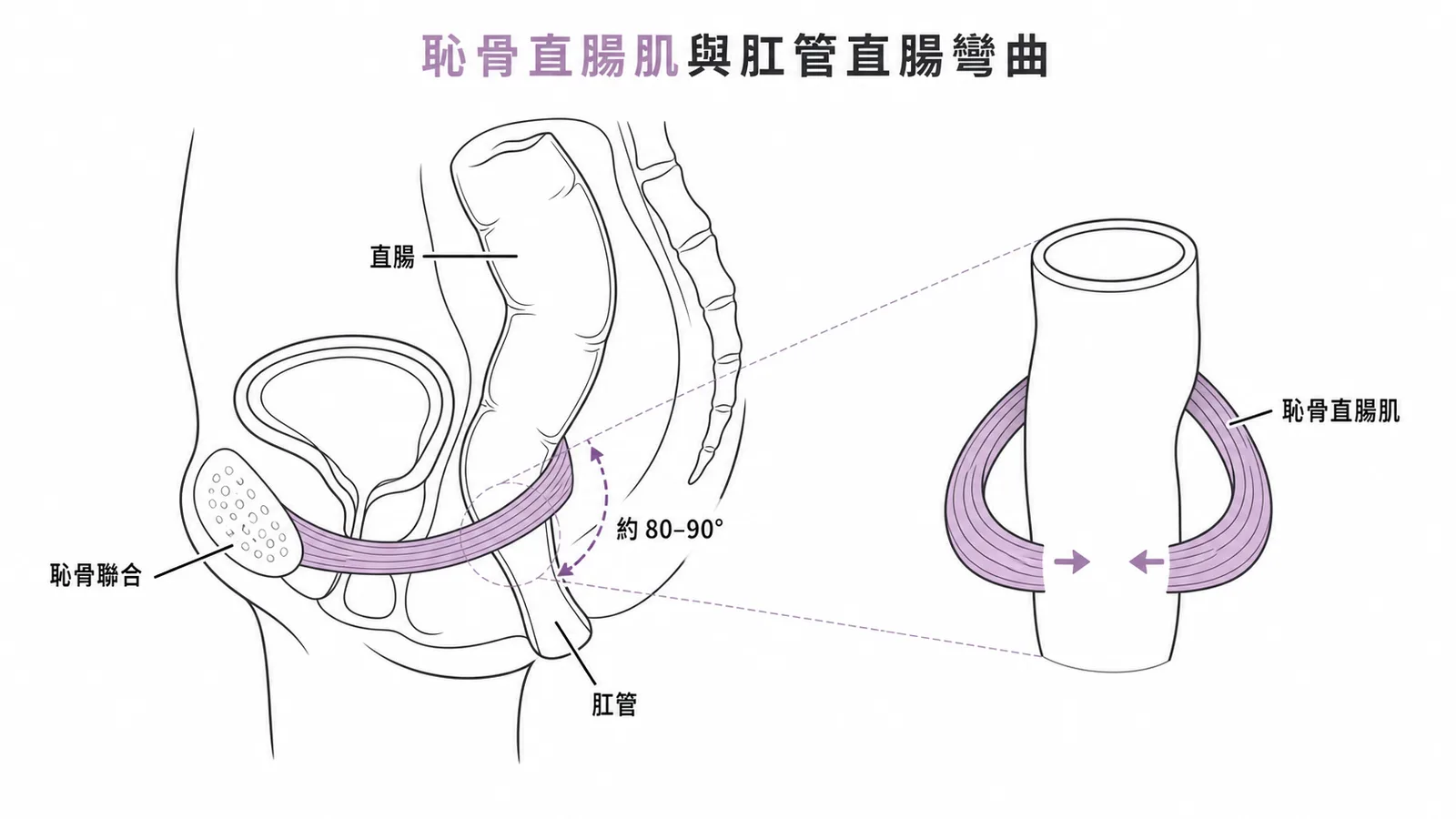 恥骨直腸肌U形環繞直腸維持肛管直腸彎曲約80-90度示意圖