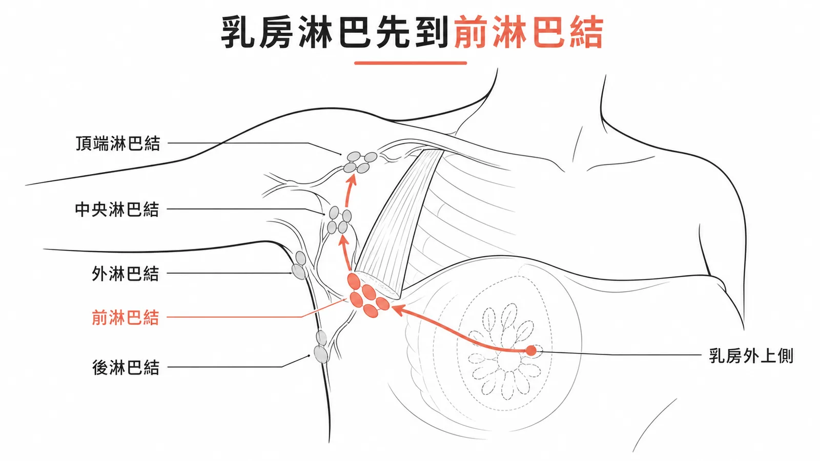 乳房淋巴先到前淋巴結——腋窩五組淋巴結位置與乳房外上側引流路徑
