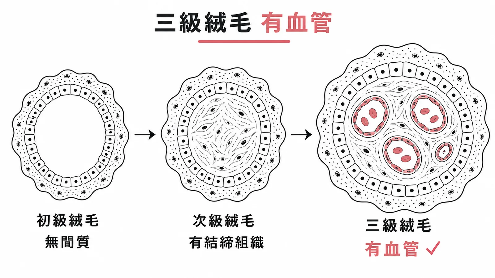 胎盤絨毛三階段：初級無間質、次級有結締組織、三級有血管
