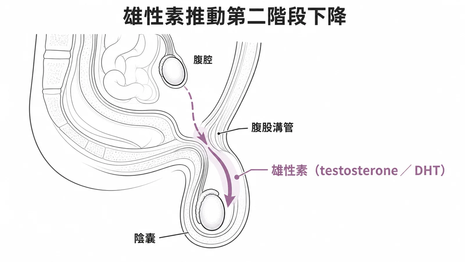 雄性素驅動睪丸經腹股溝下降至陰囊的兩階段示意圖