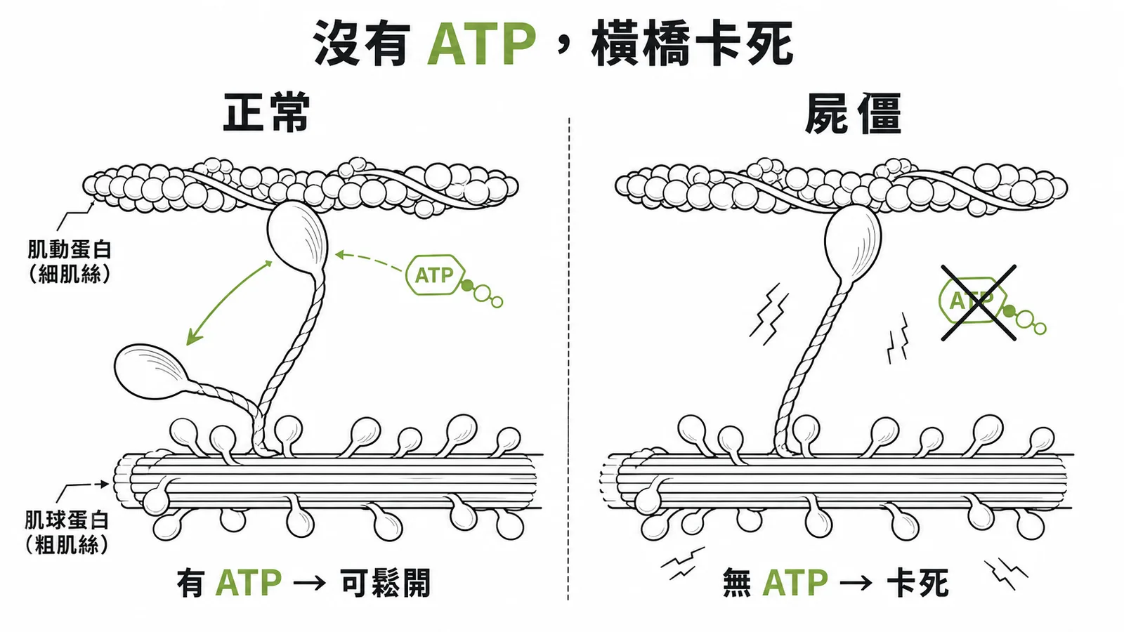 屍僵原因：缺乏 ATP 導致肌凝蛋白橫橋無法從肌動蛋白脫離