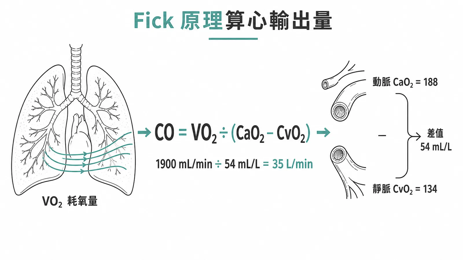 Fick 原理公式計算心輸出量的示意圖