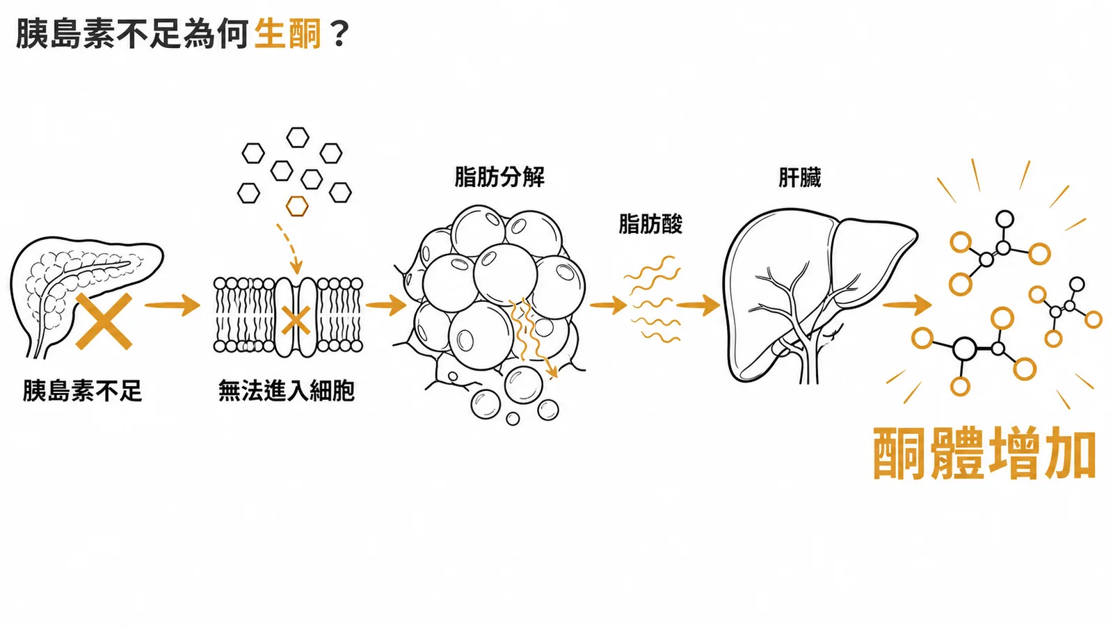 胰島素不足導致脂肪分解增加，肝臟生成酮體