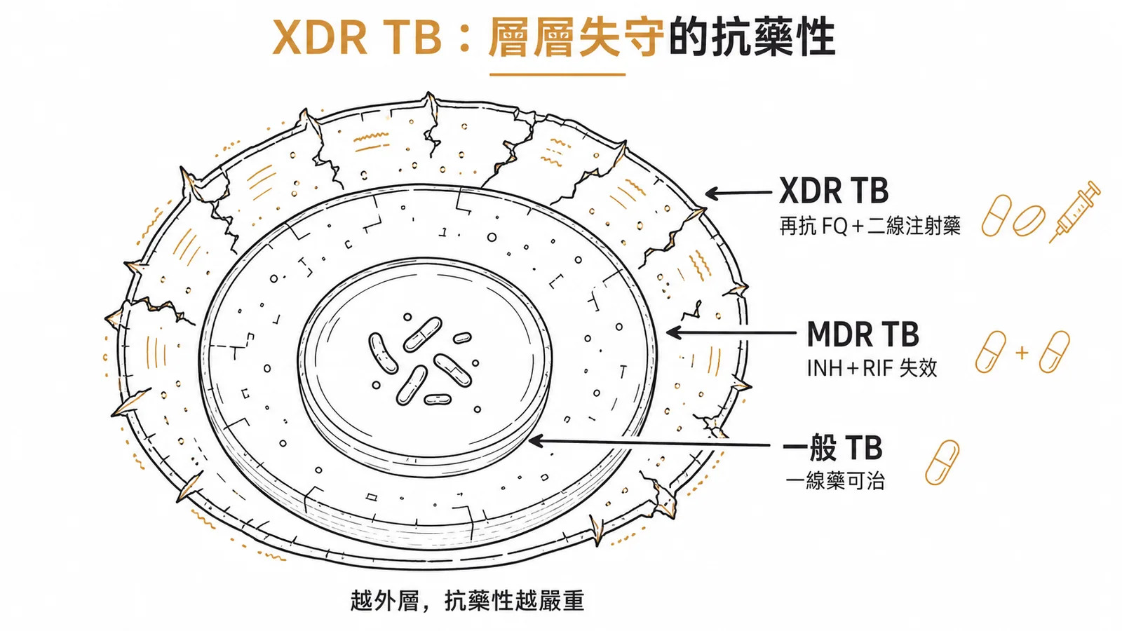 XDR TB抗藥性分層:一般TB到MDR再到XDR,層層失守的藥物抗藥性遞進