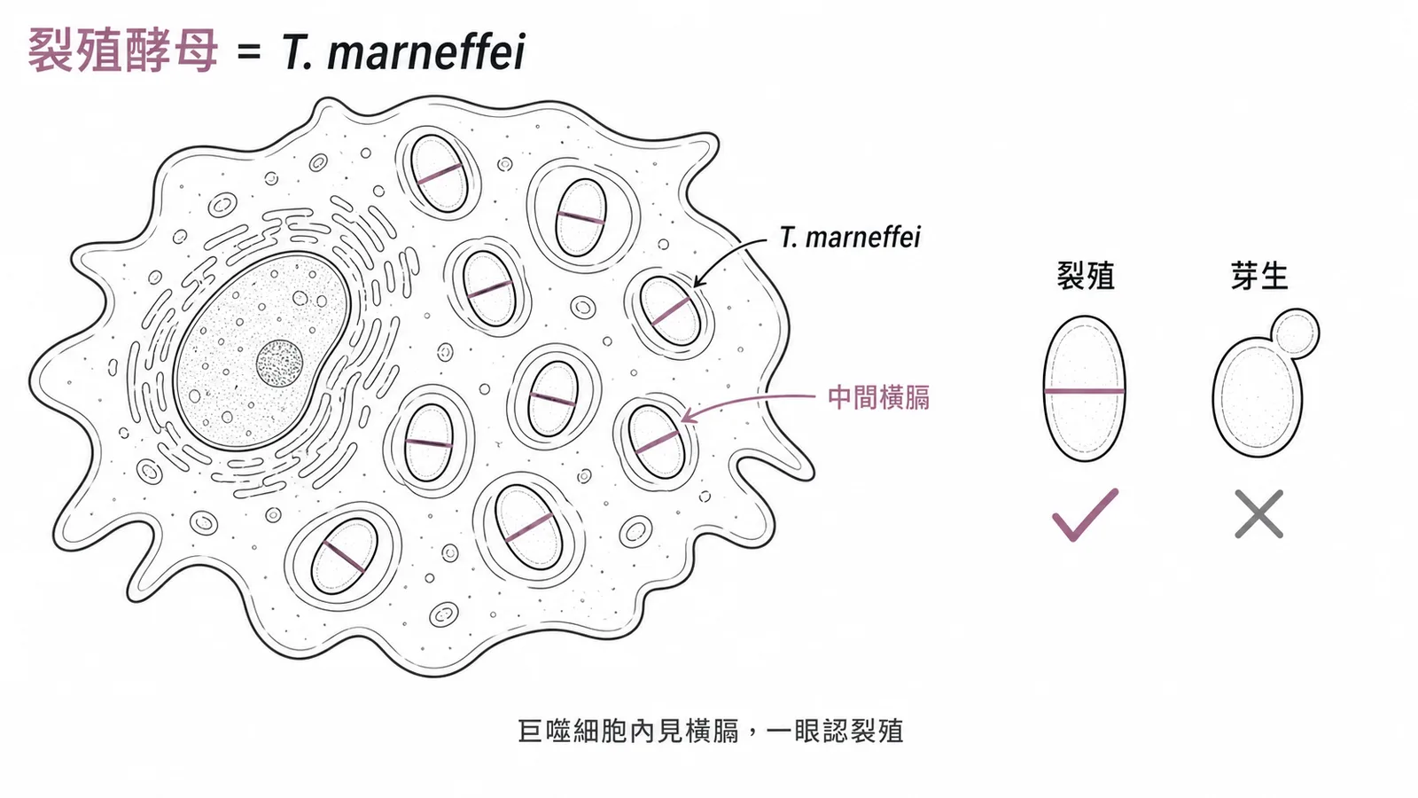 T. marneffei裂殖酵母在巨噬細胞內呈現中間橫膈一分為二的診斷特徵