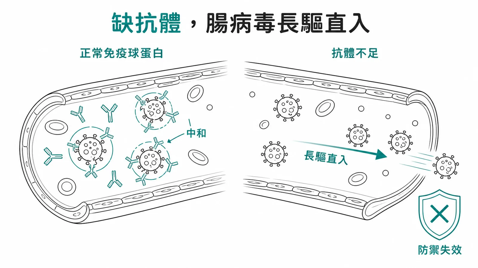 低伽瑪球蛋白血症患者缺乏抗體,腸病毒無法被中和而長驅直入