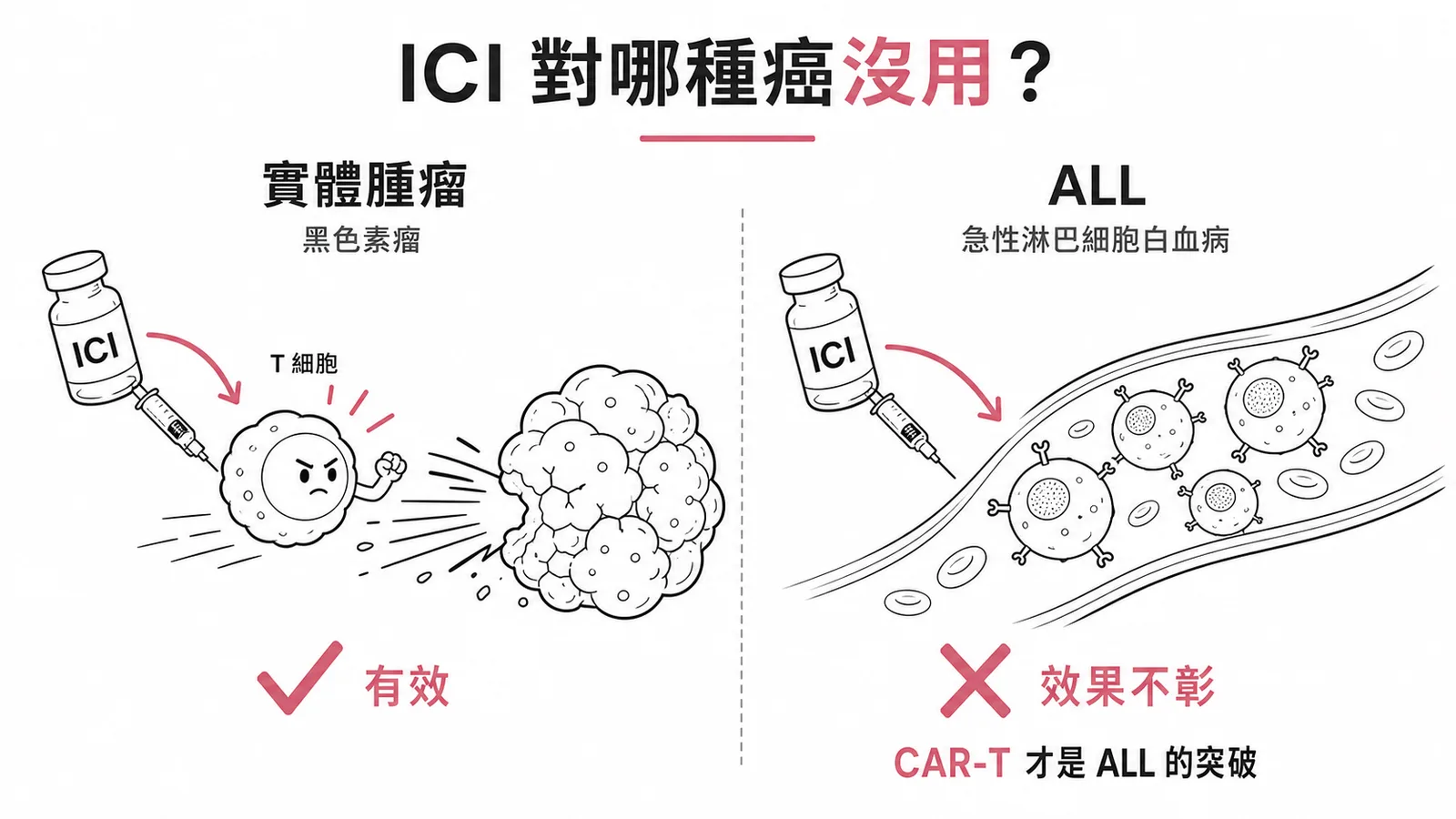 ICI 對實體腫瘤有效但對 ALL 效果不彰,ALL 靠 CAR-T