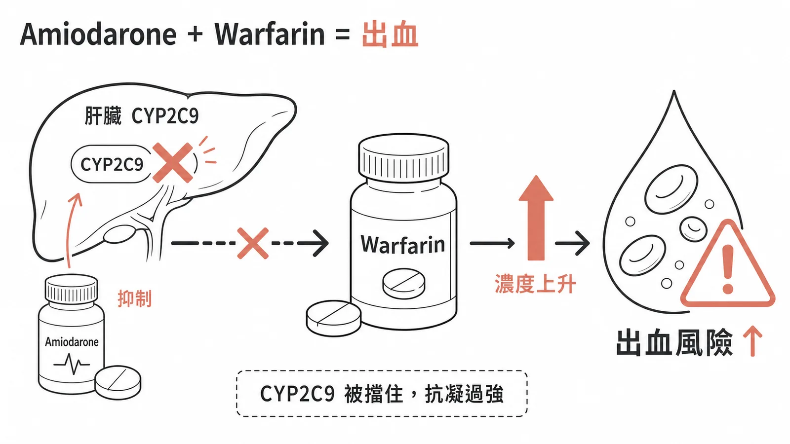 Amiodarone 抑制 CYP2C9 導致 Warfarin 濃度升高出血風險增加示意圖
