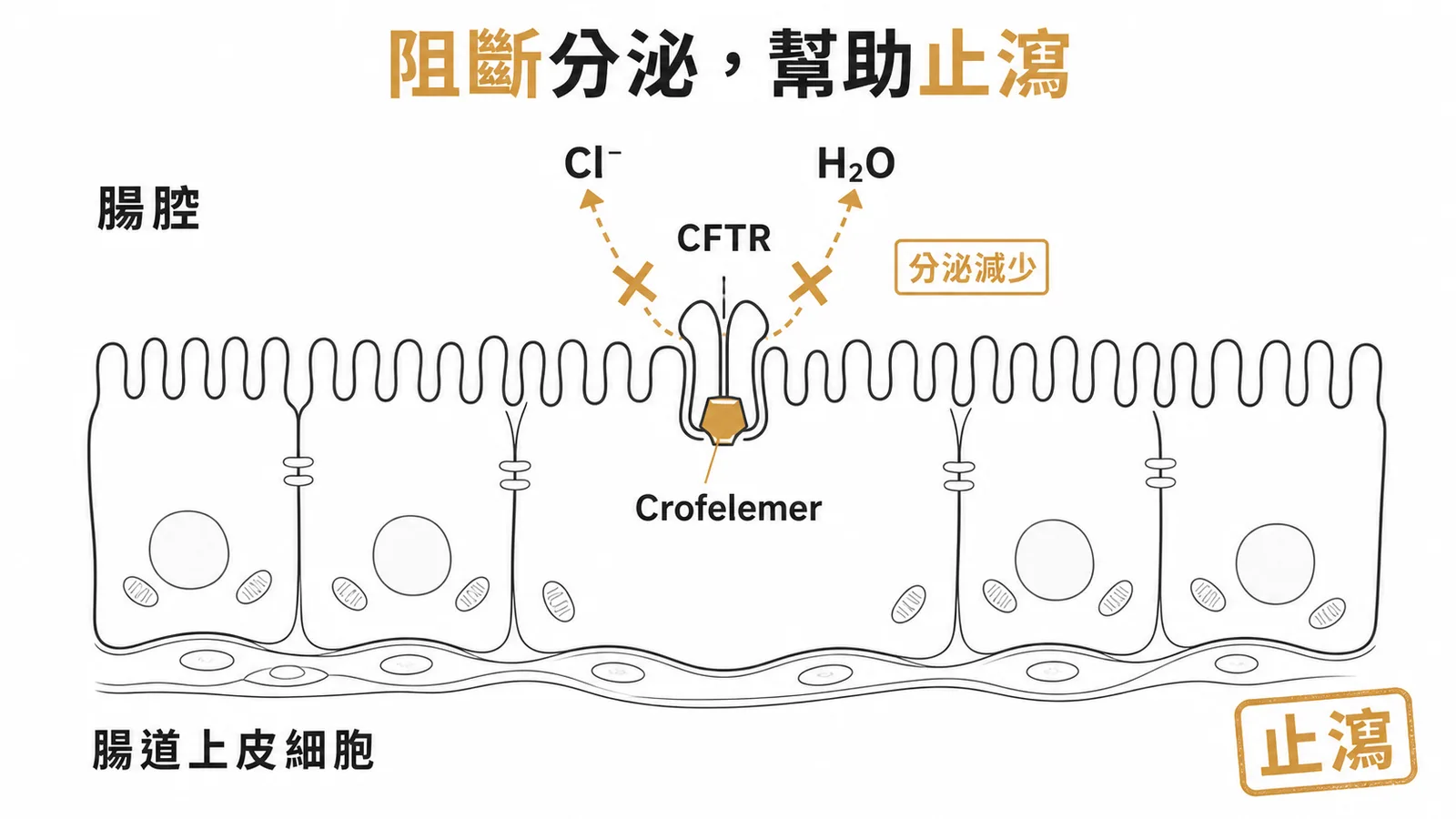 Crofelemer 抑制 CFTR 氯離子通道減少腸道水分分泌