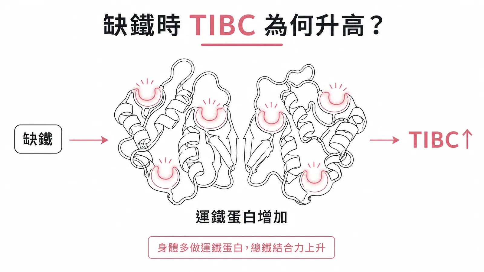 缺鐵性貧血 TIBC 升高示意：運鐵蛋白代償性增產