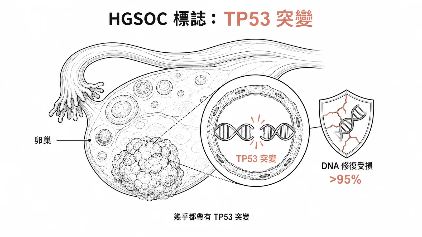 高惡性度漿液性卵巢癌 TP53 突變率超過 95% 示意圖
