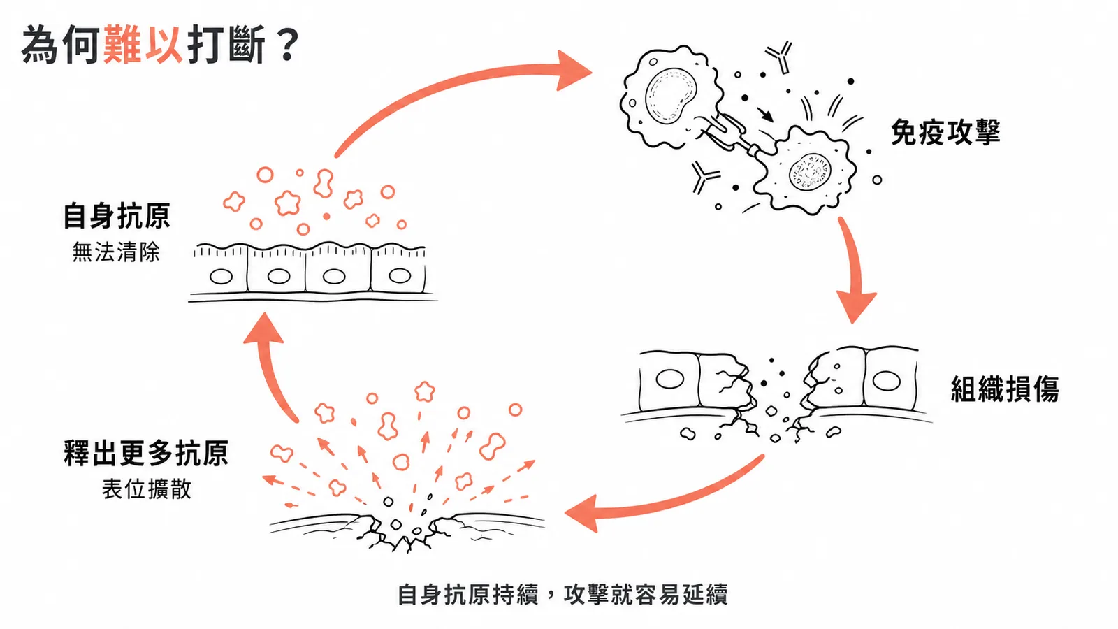 自體免疫疾病因自身抗原無法清除與表位擴散形成惡性循環