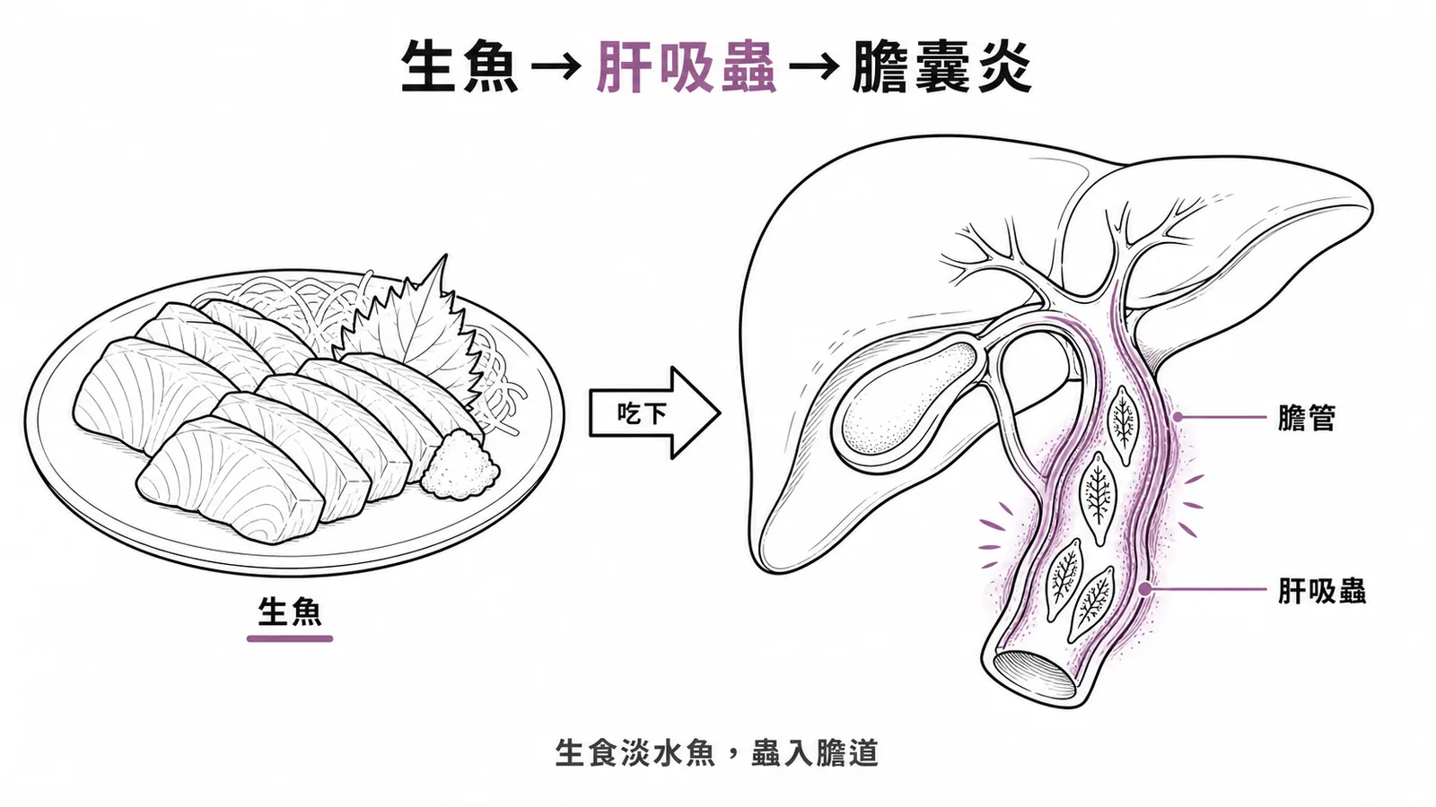 中華肝吸蟲生活史:吃生魚→囊蚴→寄生膽管的示意圖