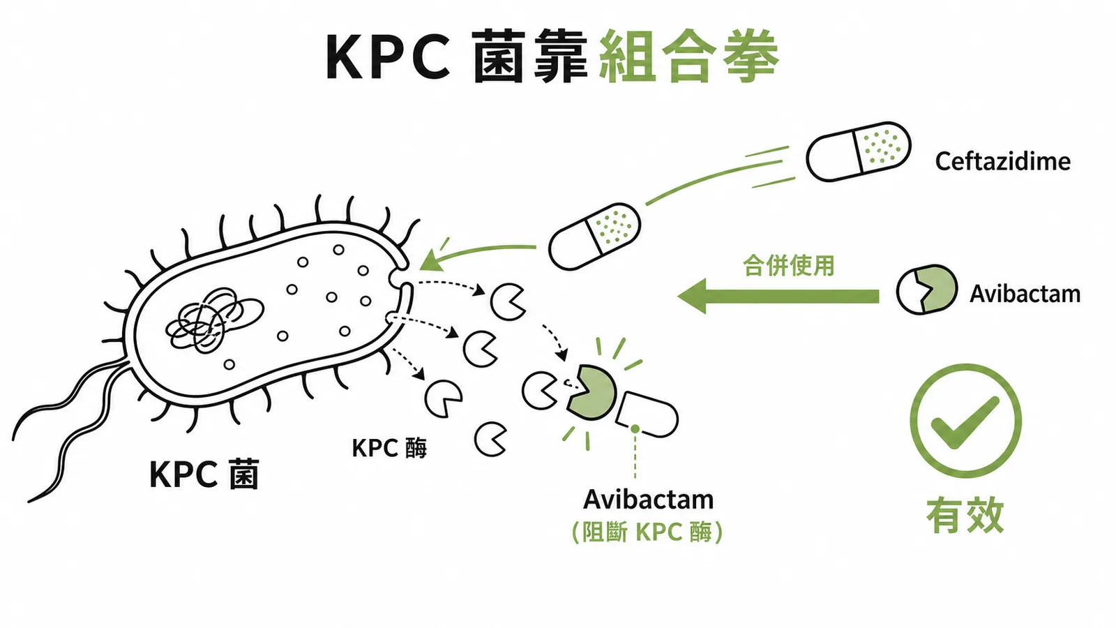 碳青黴烯酶抗藥性細菌需用Ceftazidime-avibactam組合拳示意圖