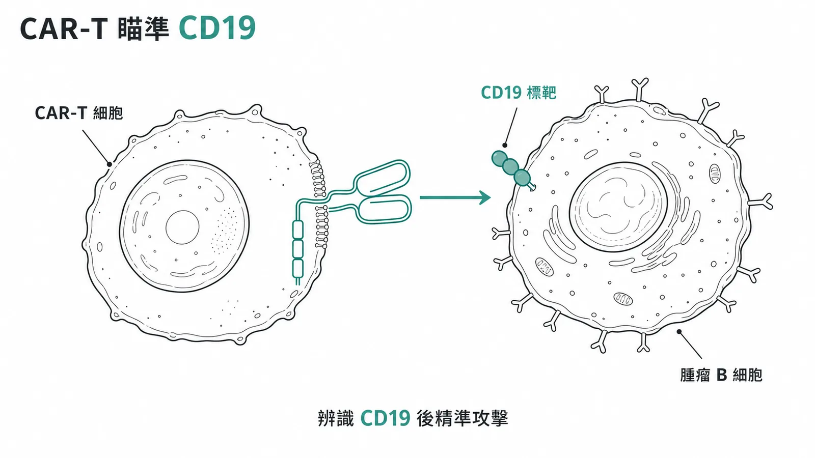 CAR-T細胞療法靶向CD19治療大B細胞淋巴瘤示意圖