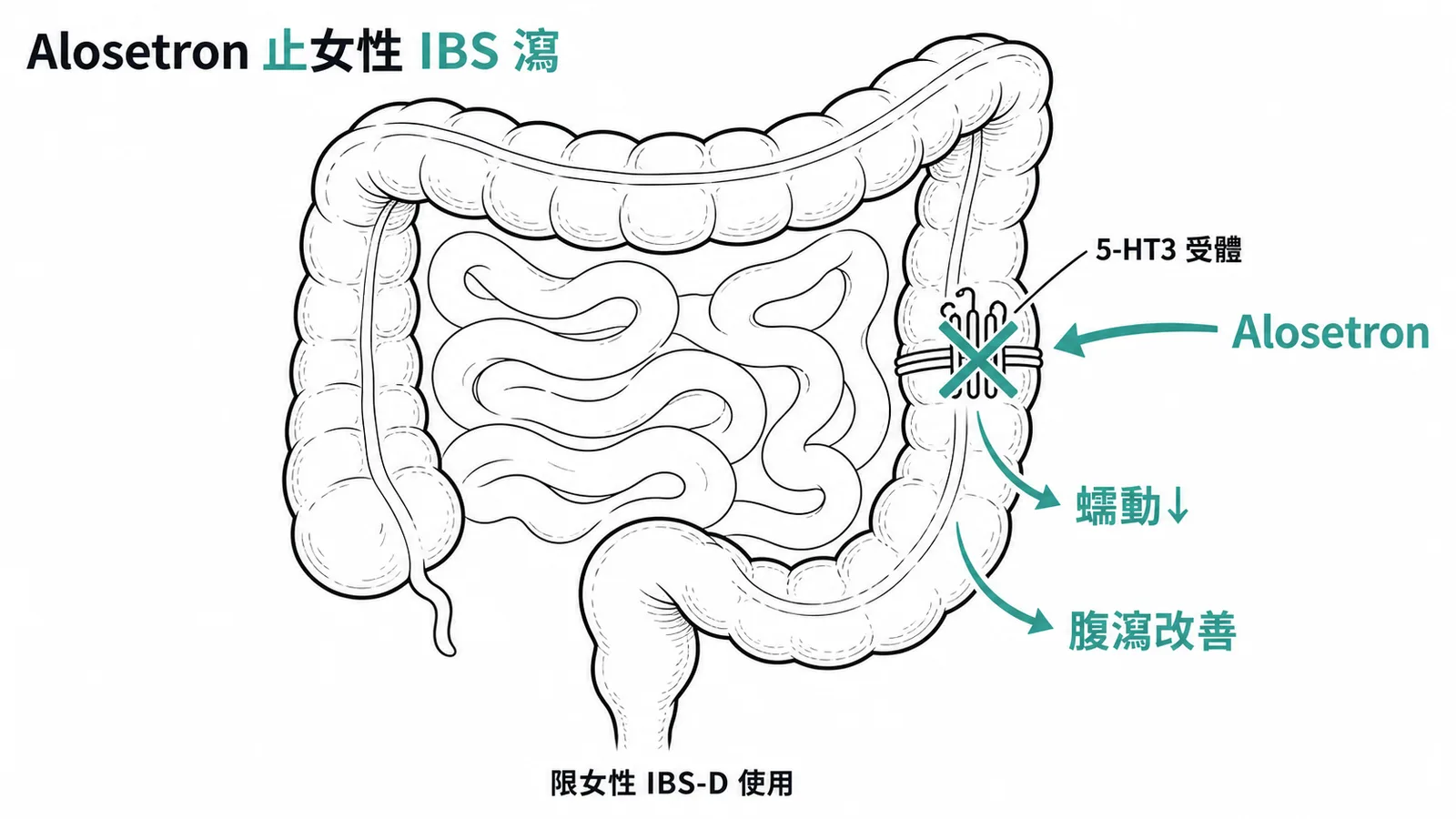 Alosetron 為 5-HT3 拮抗劑治療女性腹瀉型腸躁症示意圖