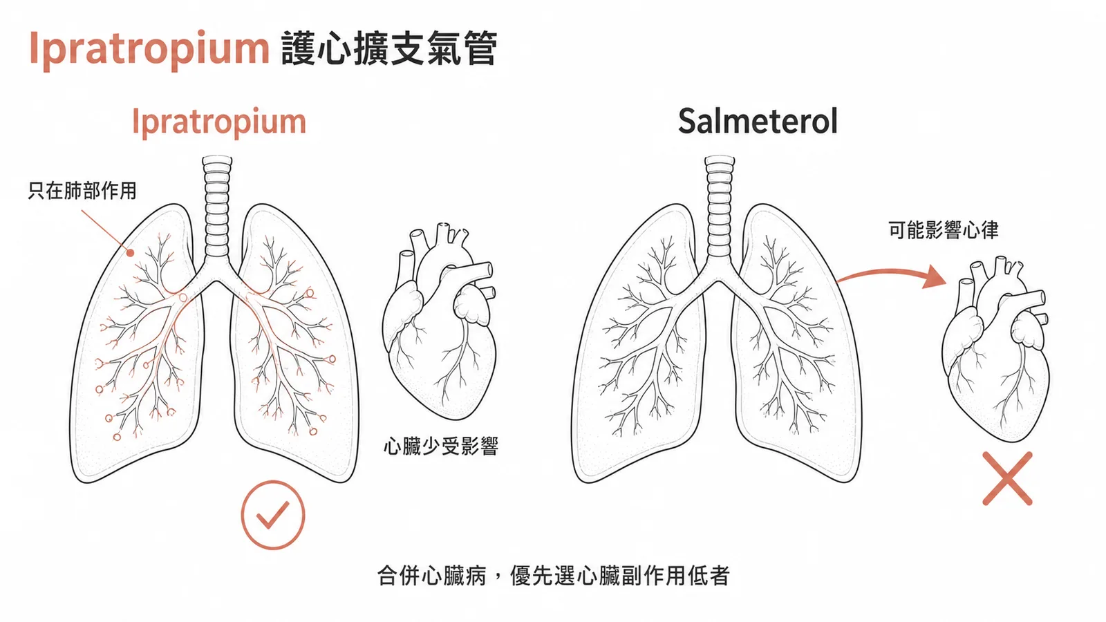 Ipratropium 抗膽鹼藥物作用局限肺部對心臟較安全示意圖