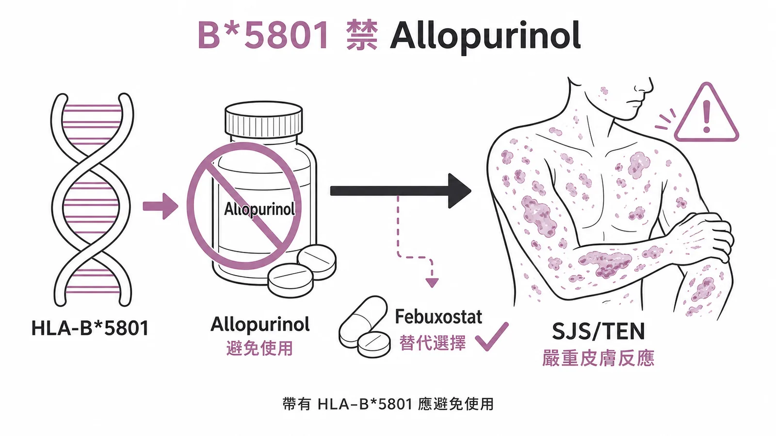 HLA-B*5801 基因變異使 Allopurinol 引發 SJS/TEN 嚴重皮膚反應示意圖