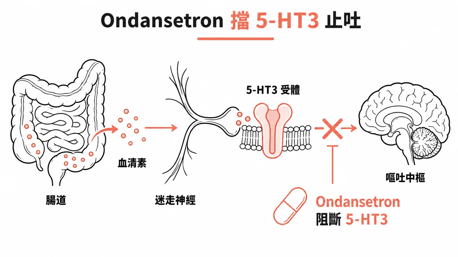Ondansetron 阻斷 5-HT3 受體預防化療噁心嘔吐示意圖