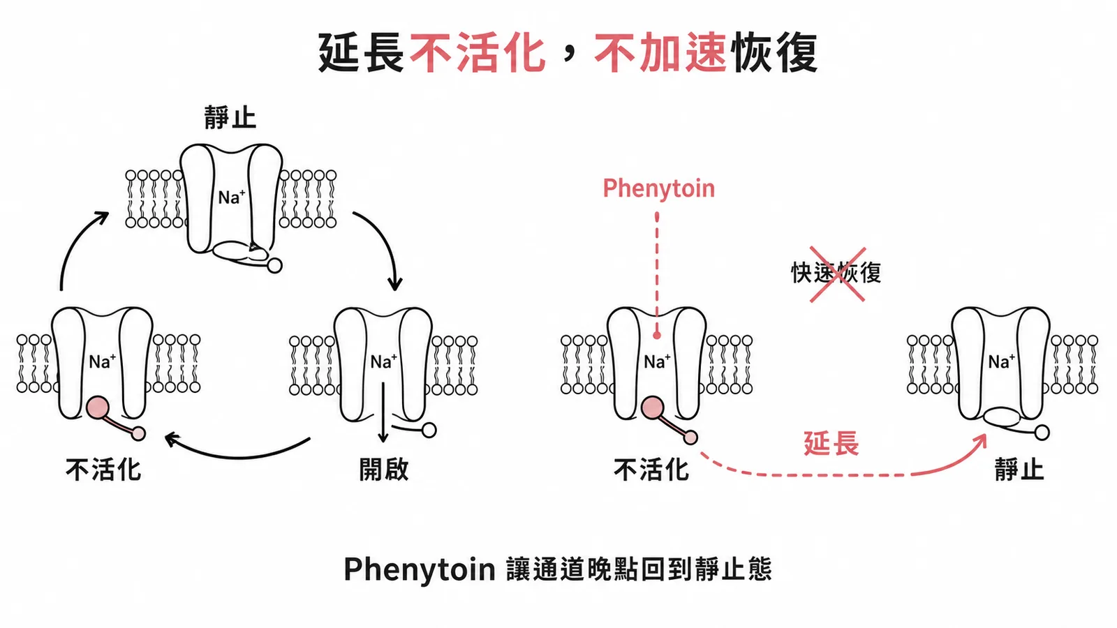 鈉離子通道阻斷劑延長不活化狀態而非加速恢復示意圖