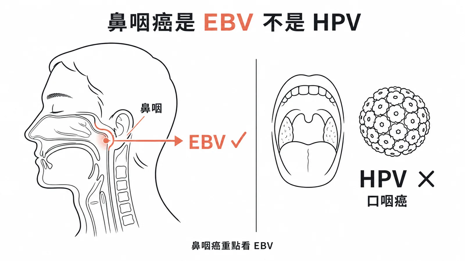 鼻咽癌與 EBV 高度相關，HPV 相關的是口咽癌而非鼻咽癌
