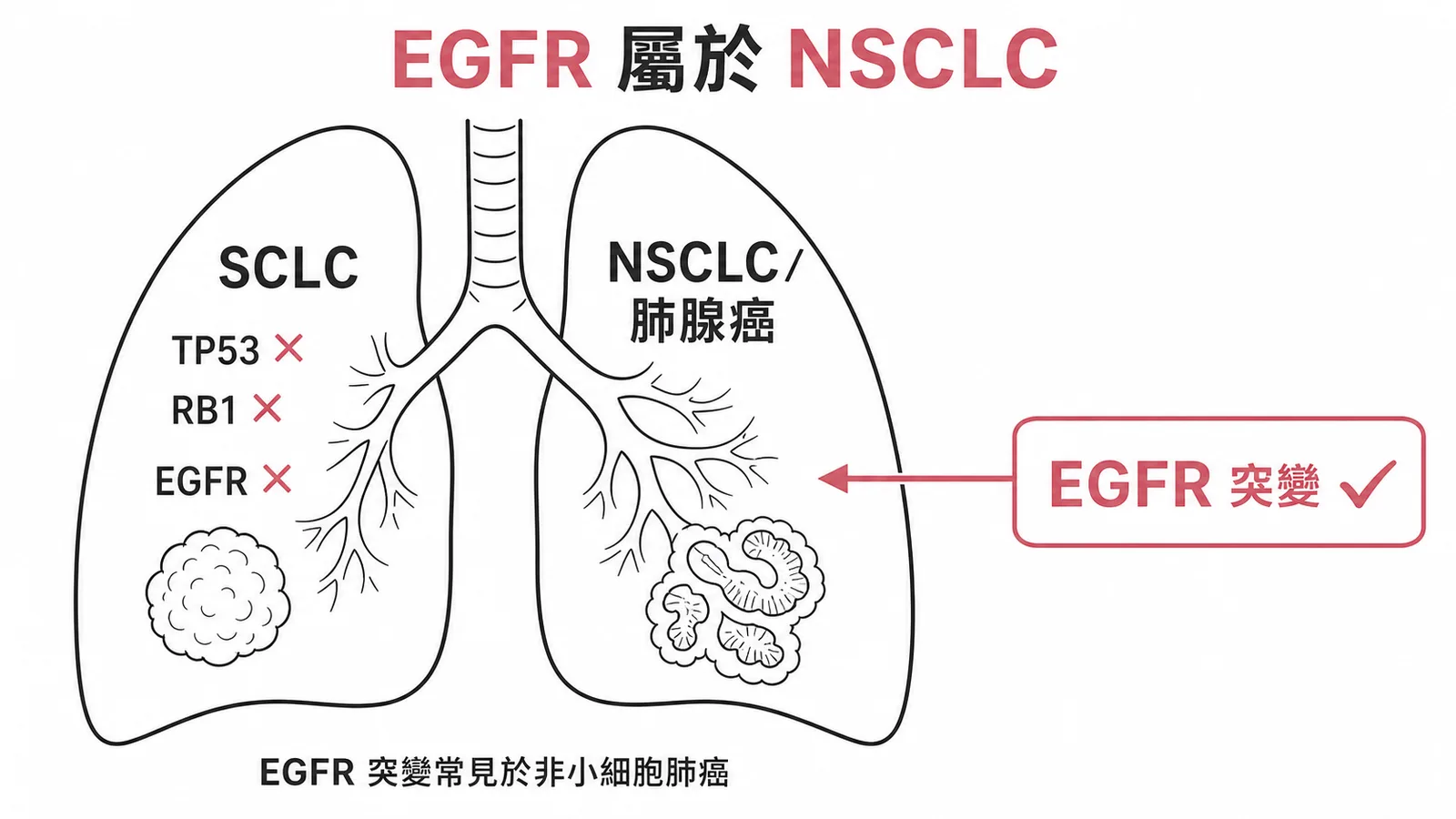 小細胞肺癌的基因突變是 TP53 和 RB1 失活，EGFR 突變屬於非小細胞肺癌