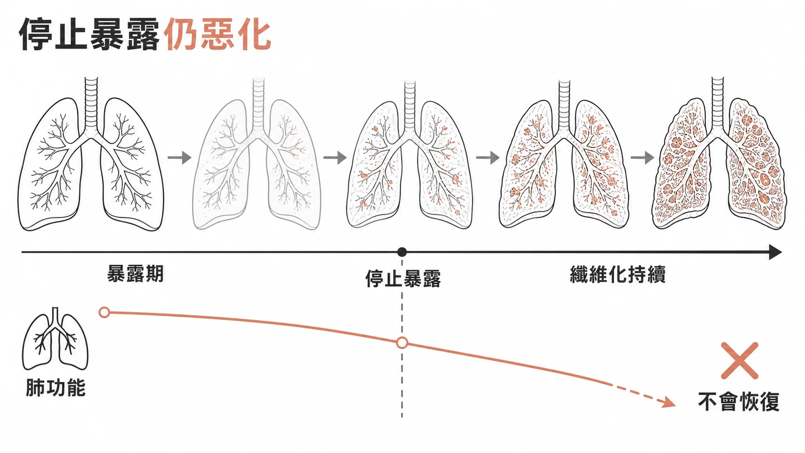 矽肺病即使停止暴露，肺纖維化仍持續惡化，肺功能不會恢復