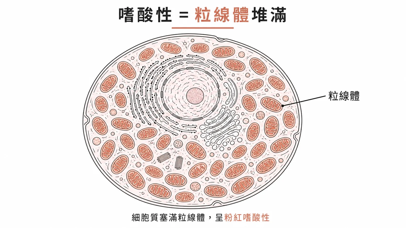 腎嗜酸細胞瘤的嗜酸性染色源自細胞質內大量密集的粒線體