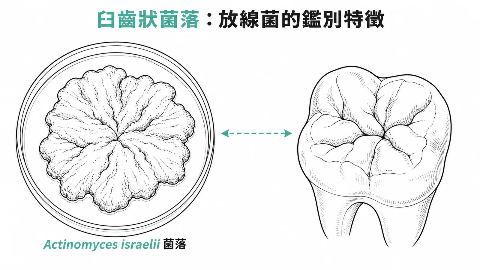以色列放線菌菌落形態對照臼齒咬合面的相似外觀