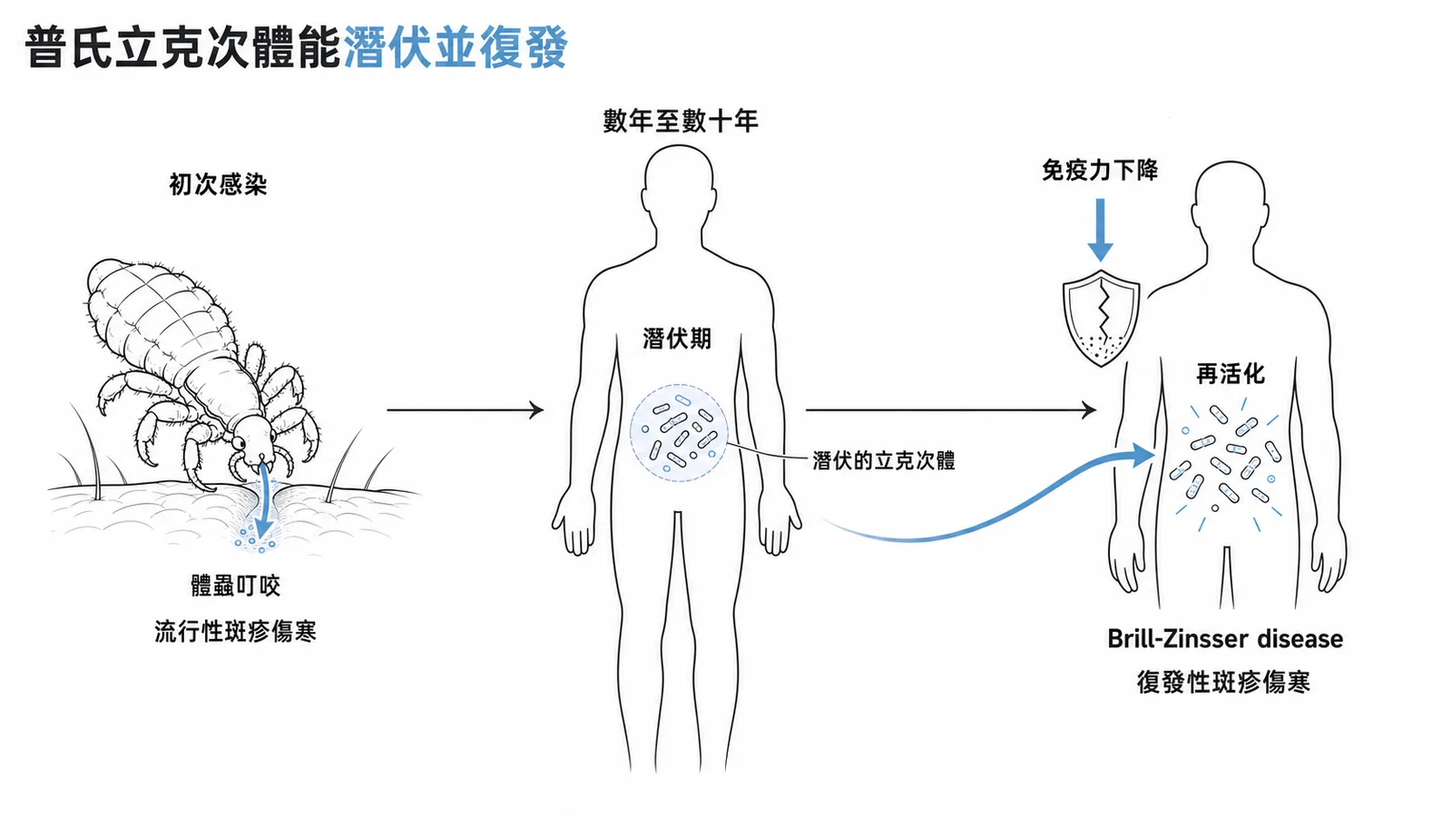 普氏立克次體從初次感染到潛伏數年後復發為 Brill-Zinsser disease 的時間軸