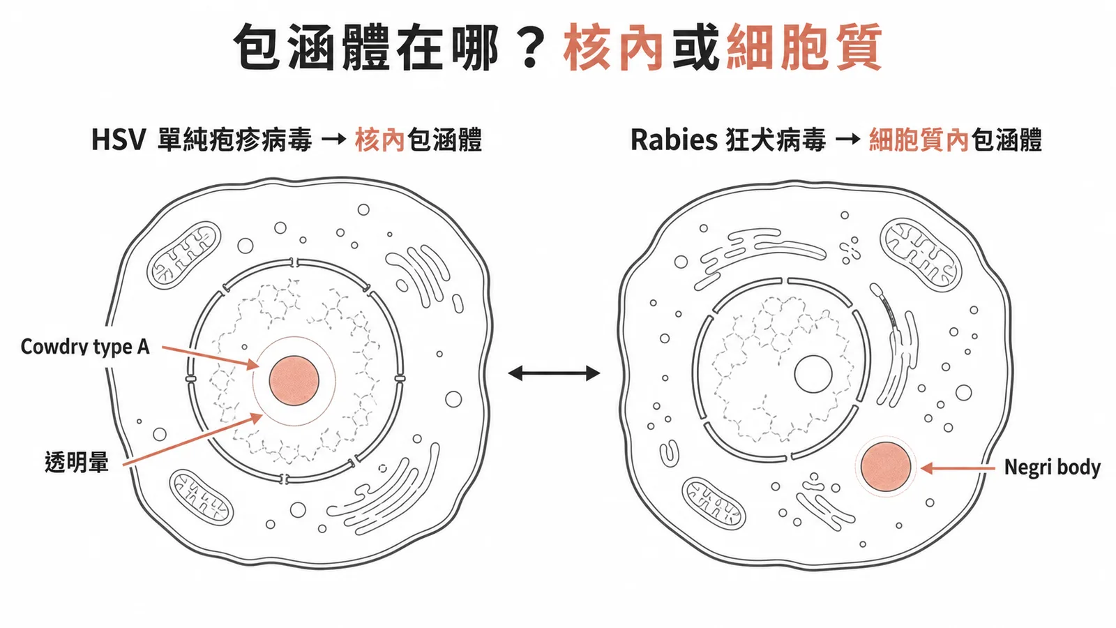 HSV 核內 Cowdry A 包涵體與狂犬病毒細胞質內 Negri body 的位置對照
