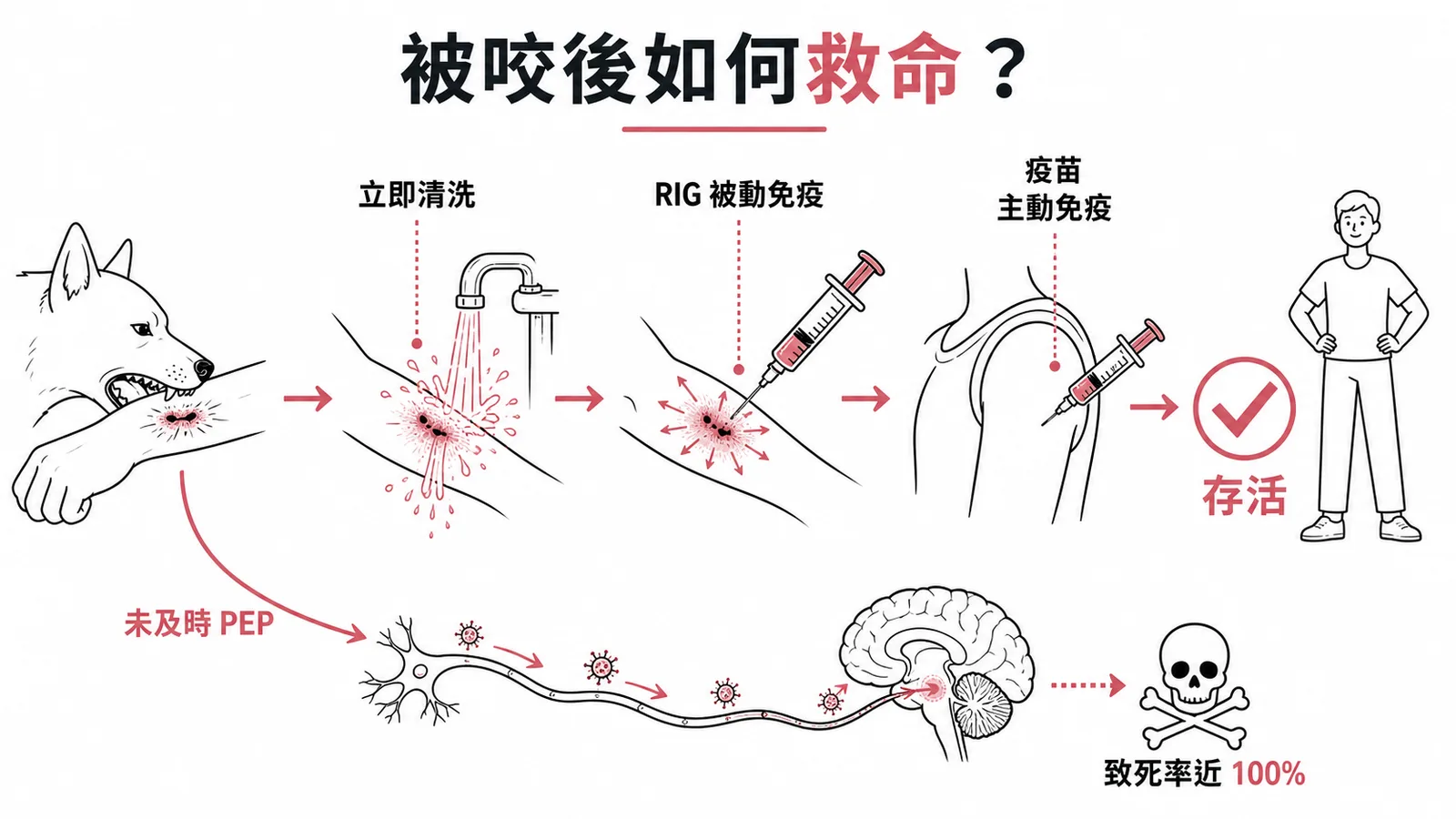 狂犬病暴露後預防PEP流程:清洗傷口加RIG加疫苗可救命