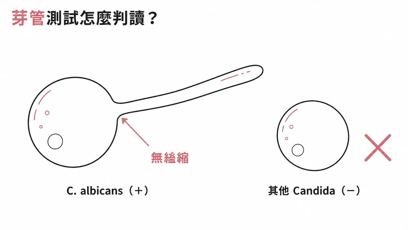 芽管測試陽性代表白色念珠菌無縊縮管狀結構