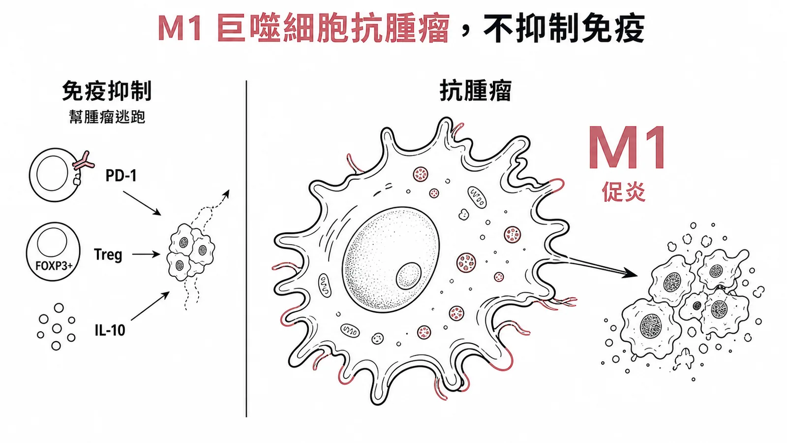 腫瘤微環境對照:PD-1、Treg、IL-10 抑制免疫,M1 巨噬細胞促炎抗腫瘤