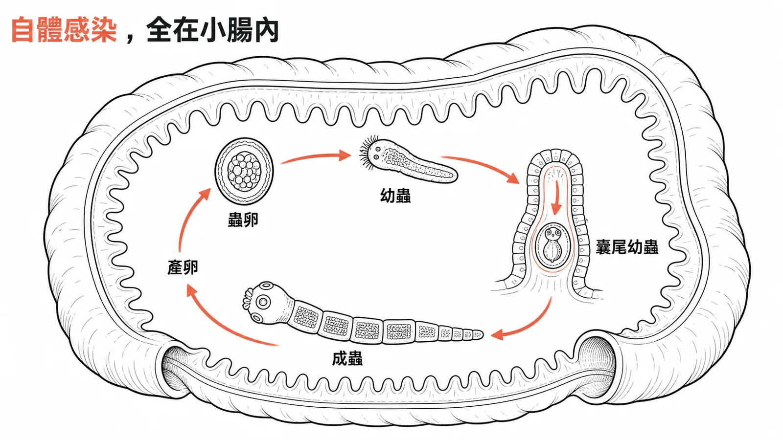 短小包膜絛蟲自體感染循環:蟲卵→幼蟲→囊尾幼蟲→成蟲,全在小腸內完成