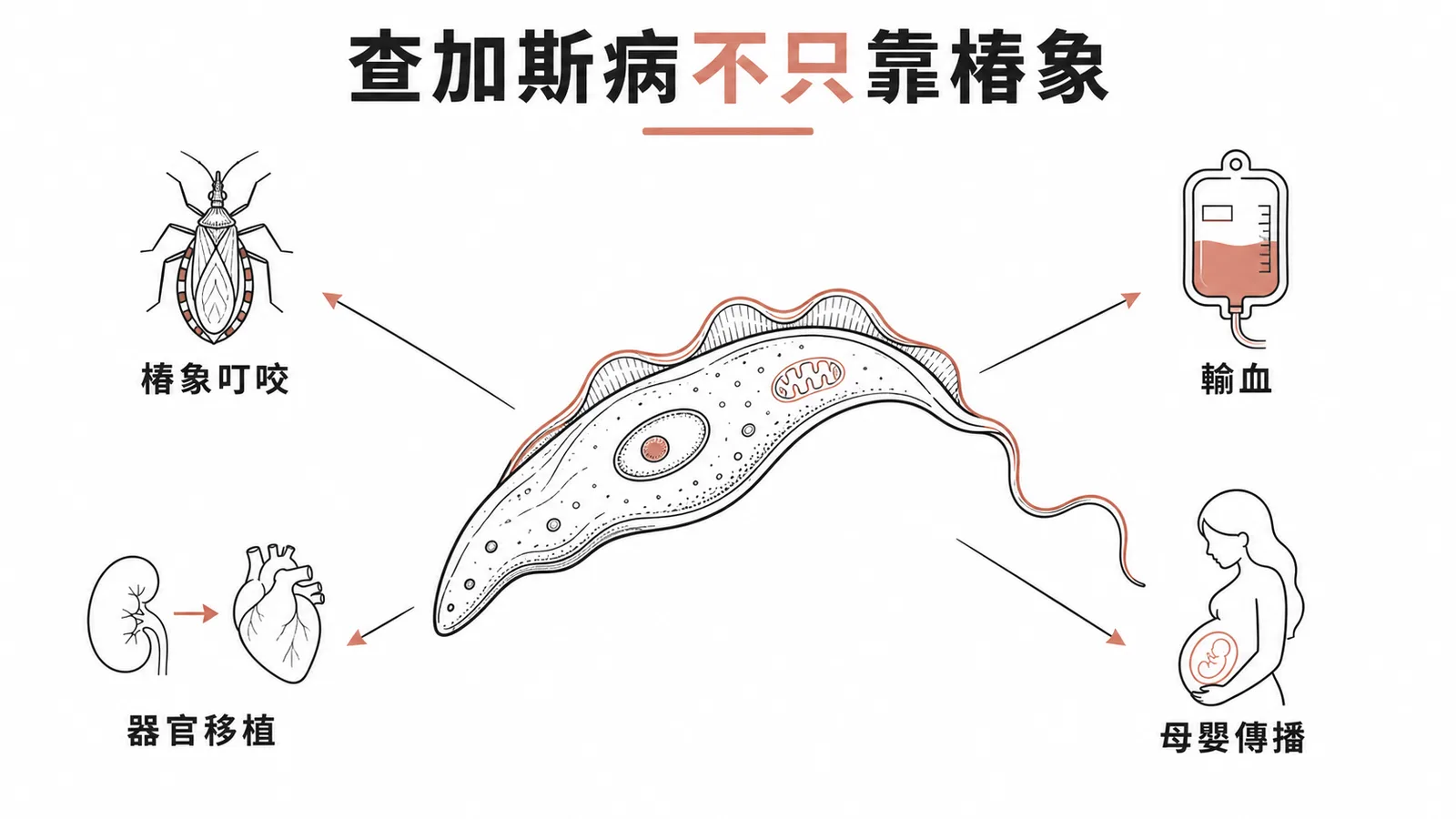 查加斯病傳播途徑:不只椿象叮咬,還有輸血、器官移植、母嬰垂直傳播
