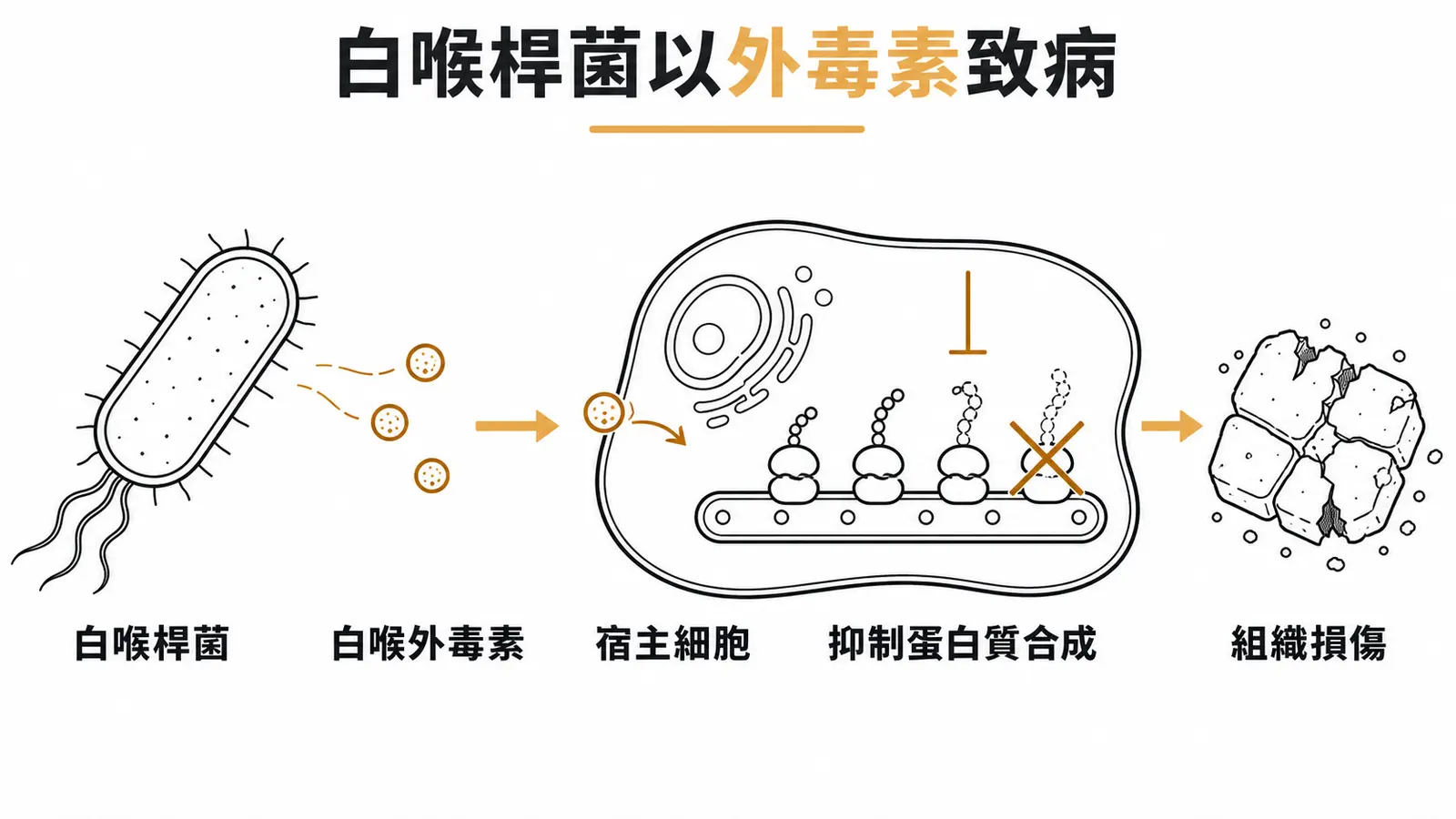白喉桿菌分泌外毒素抑制宿主細胞蛋白質合成的致病機轉示意圖