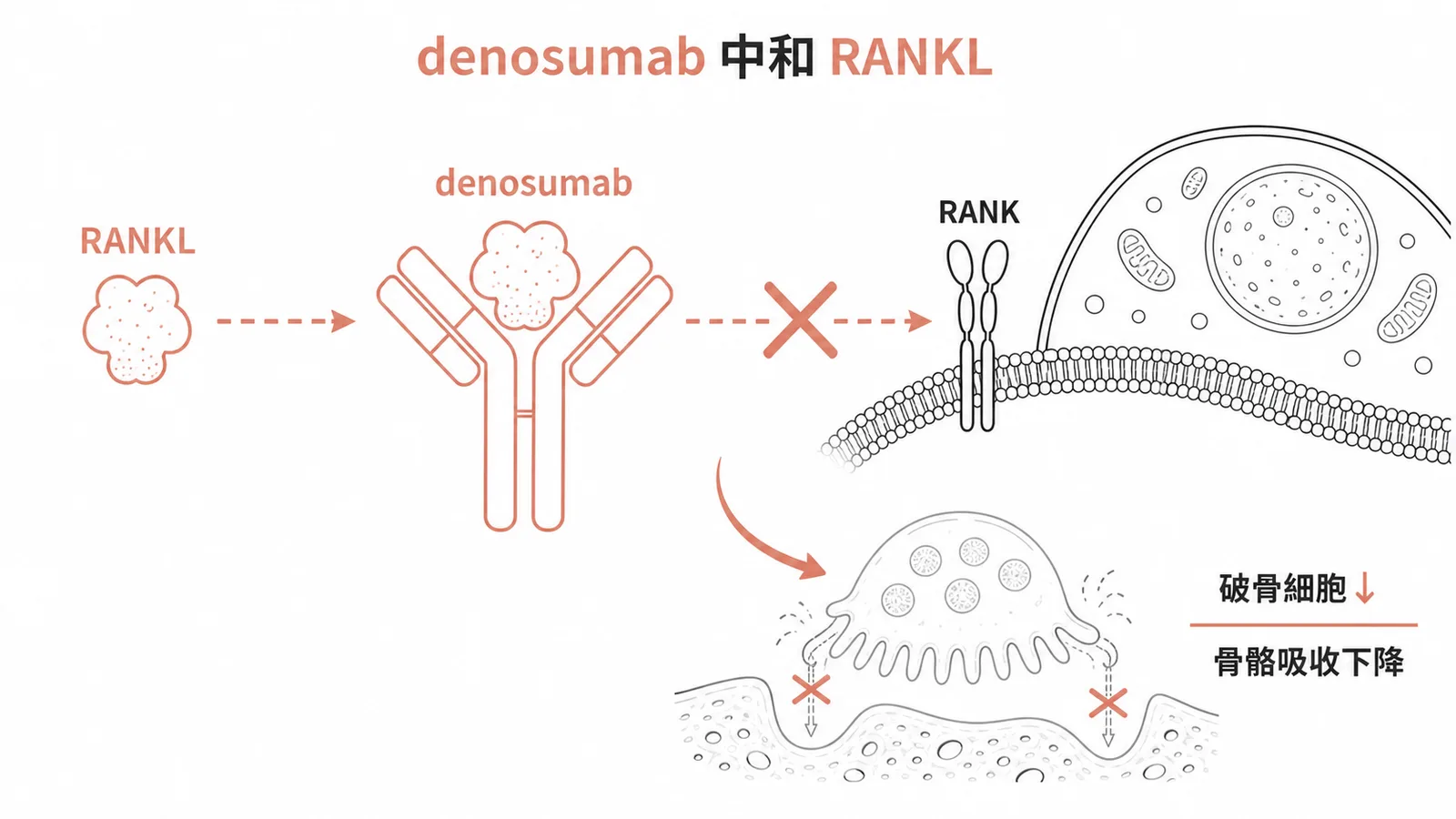 denosumab 為抗 RANKL 單株抗體,中和 RANKL 阻止其與破骨細胞的 RANK 結合,抑制破骨細胞而減少骨骼吸收