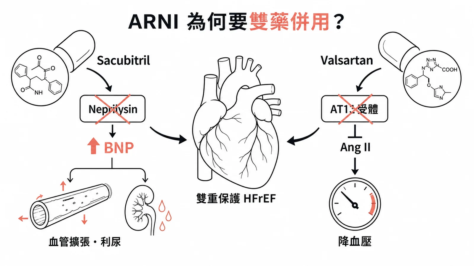 ARNI 雙重機制：Sacubitril 抑制 neprilysin 保留 BNP 促血管擴張利尿，Valsartan 阻斷 AT1 受體抑制 Ang II 降血壓