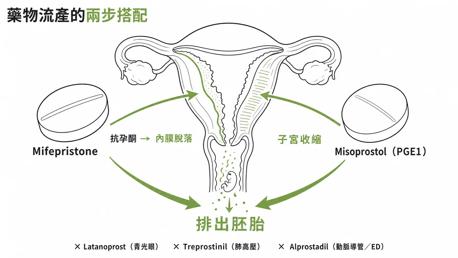 Misoprostol 為 PGE1 類似物，引起子宮收縮，搭配 Mifepristone（抗孕酮使內膜脫落）用於藥物流產排出胚胎