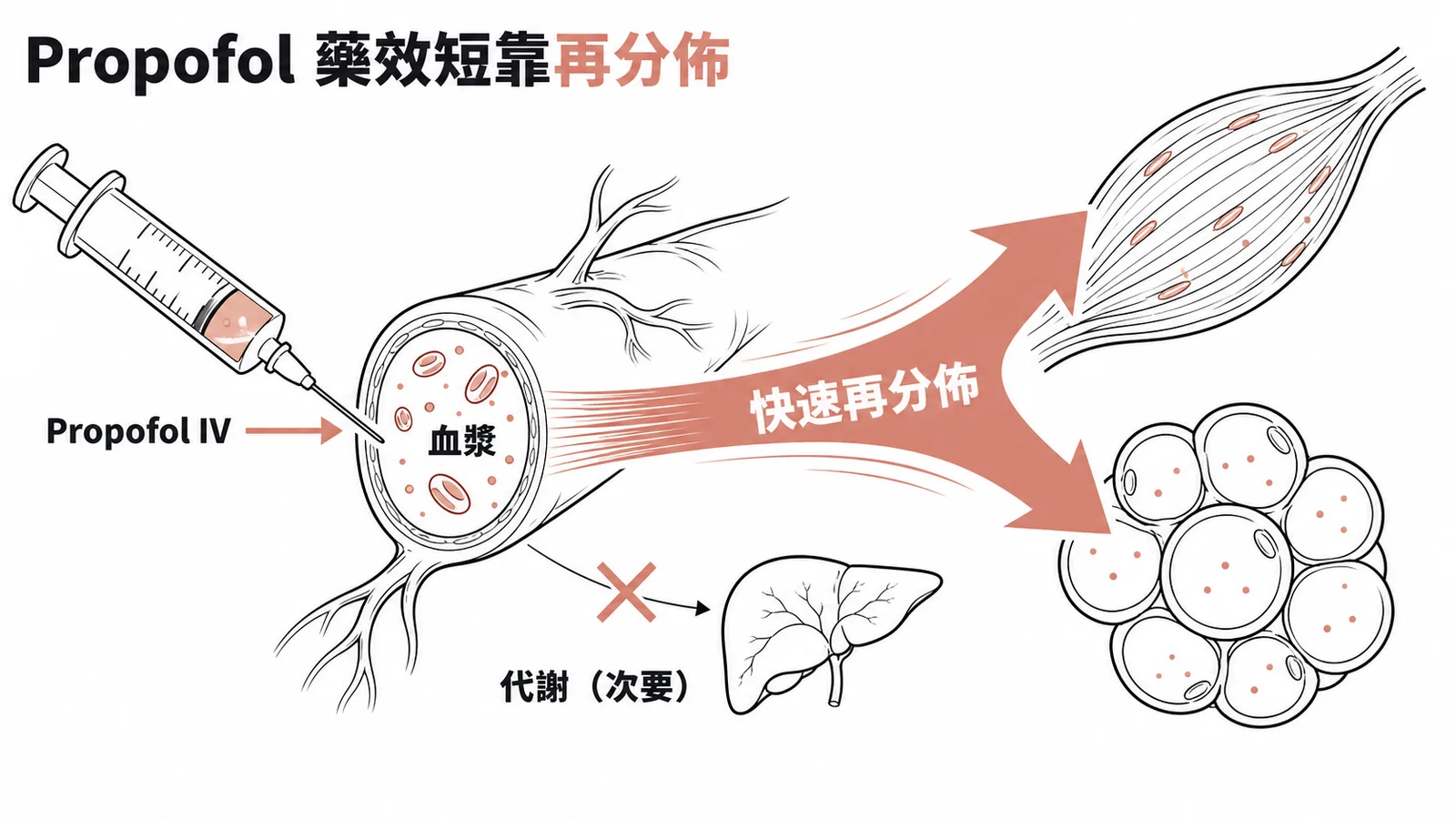 Propofol 藥效短的原因是快速再分佈而非肝臟代謝