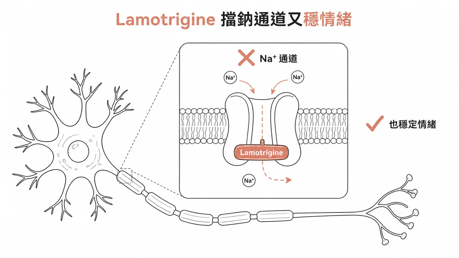 Lamotrigine 同時抑制鈉通道又能改善憂鬱
