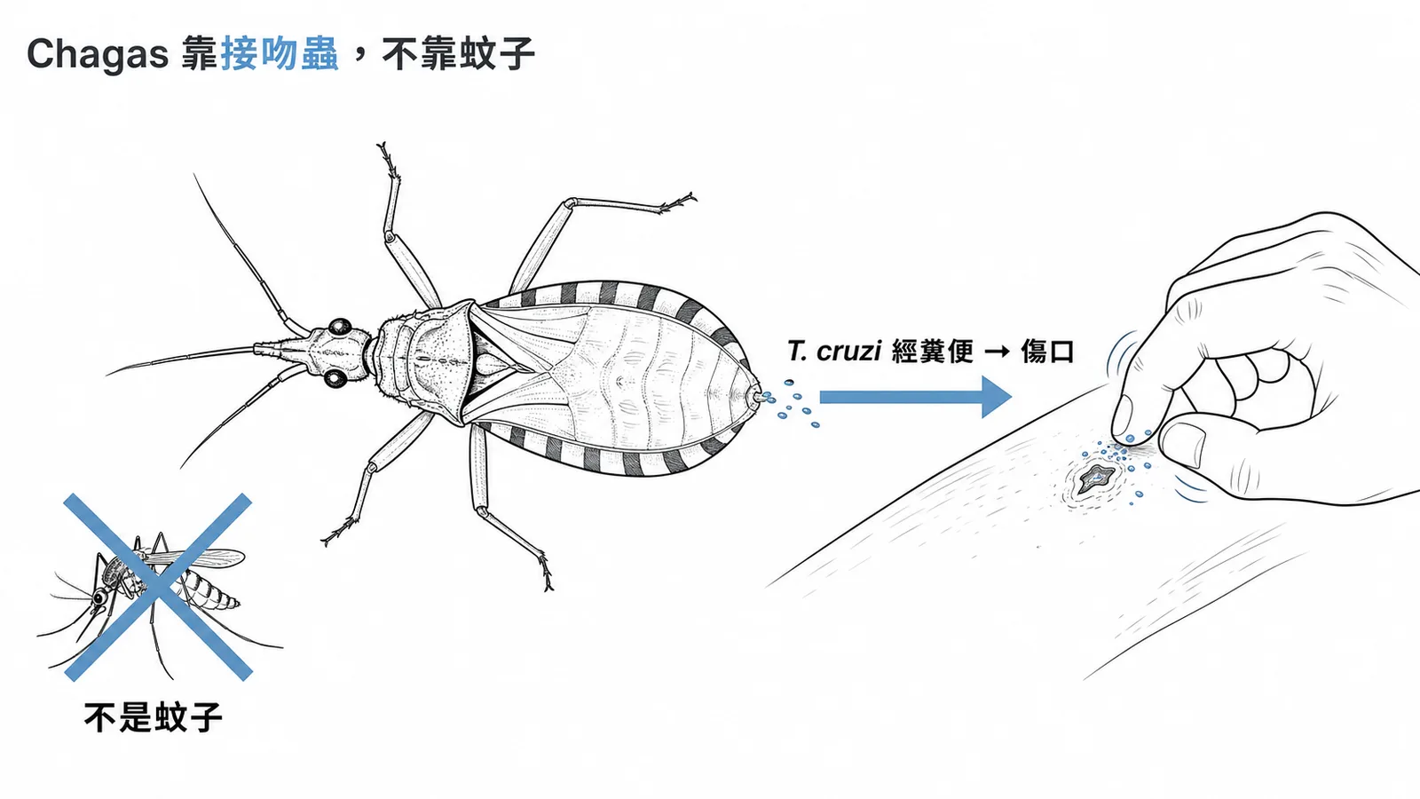 Chagas disease 由錐蟲蟲媒傳播而非蚊子